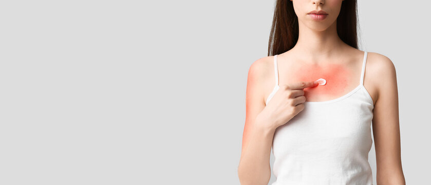 蕁麻疹やダニ刺されの正しい治し方