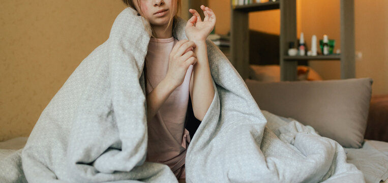 風邪を引くと蕁麻疹が出る原因