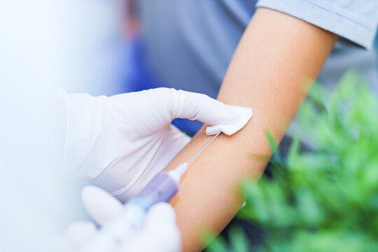 蕁麻疹の原因を特定するための検査方法